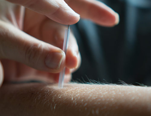 How does acupuncture work? Another study is looking at the issue
