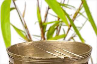 Acupuncture in West Palm Beach